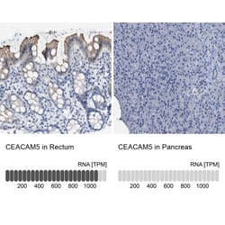 CEACAM5/CD66e Antibody, Novus Biologicals 25 &mu;L; Unlabeled:Antibodies,